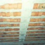 Asmolen Döşeme | Dişlerin Alttan Görünüşü